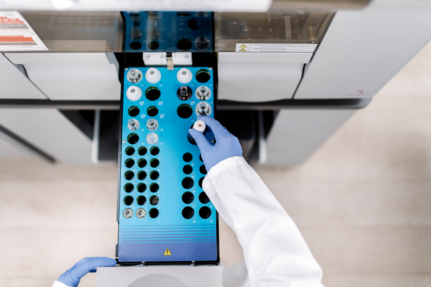 Lucence and Yemaachi Launch the AMBER Study to Detect and Characterize ...